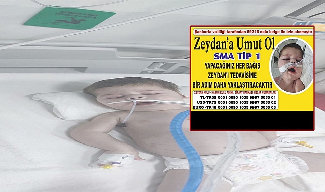Urfa'da SMA'lı Zeydan bebek destek bekliyor