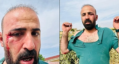 HDP Şanlıurfa İl Eş Başkanı Av.Atış saldırıya uğradı