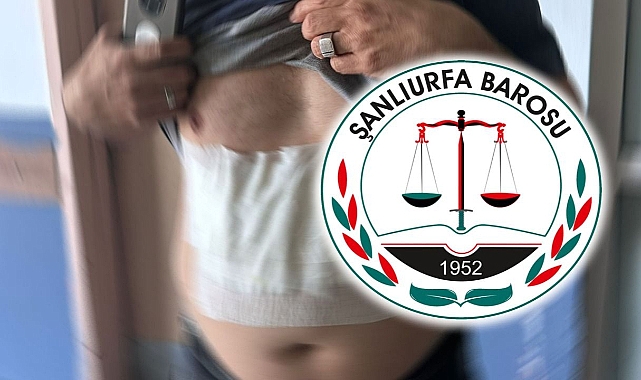 Sandık görevlisine saldırı olayıyla ilgili Şanlıurfa Barosu’ndan açıklama!