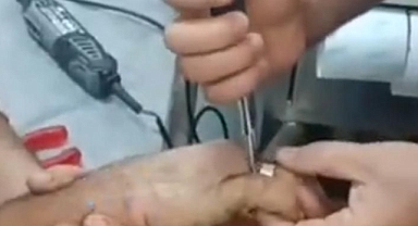 Urfa'da 2 vatandaşın parmaklarına cıvata ve yüzük sıkıştı!