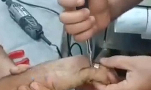 Urfa'da 2 vatandaşın parmaklarına cıvata ve yüzük sıkıştı!