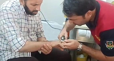 Urfa'da parmağına yüzük takan vatandaş hastanelik oldu!