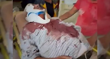 Şanlıurfa'da feci kaza: Kamyonun altında kaldı