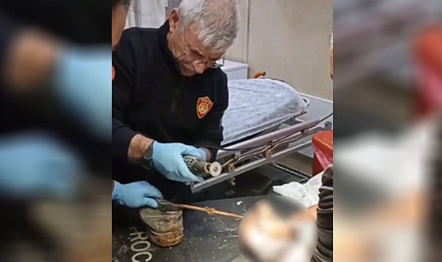 Urfa’da talihsiz kaza! Ayağına inşaat demiri saplandı!