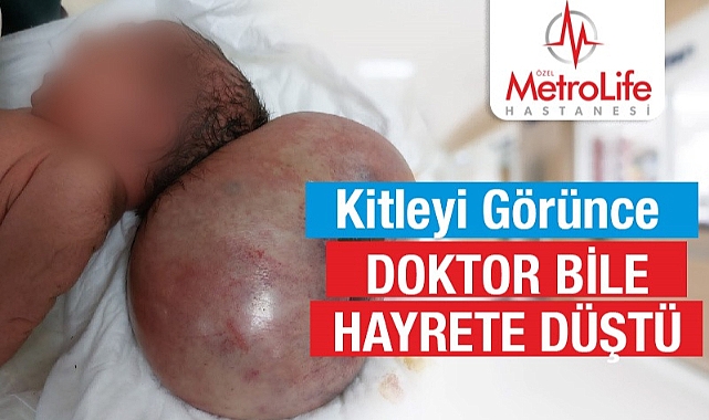 Özel Metrolife Hastanesi getirilen bebek burada 11 günlük iken ameliyata alındı.