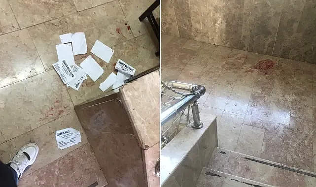 Şanlıurfa’da bir seçim kavgası daha!