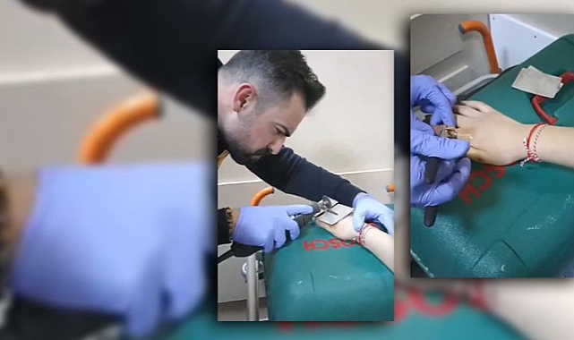 Urfa'da parmağına yüzük sıkışan genç kız hastanelik oldu!