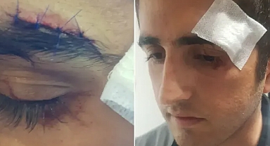 Urfa’daki hastanede çalışan güvenlik görevlisi saldırıya uğradı!