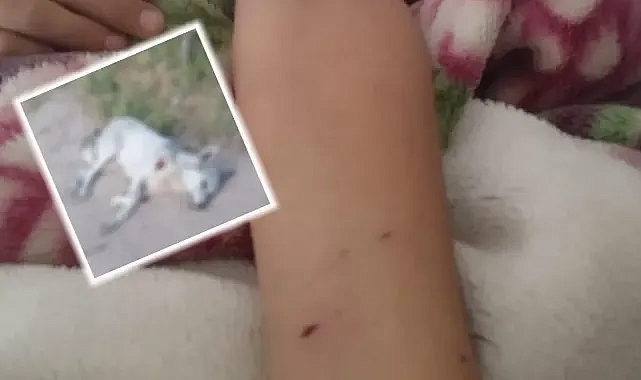 Urfa’da kurt dehşeti! 2 çocuk yaralandı!