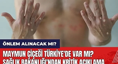 Maymun çiçeği Türkiye'de görüldü mü? Kısıtlama mı gelecek?