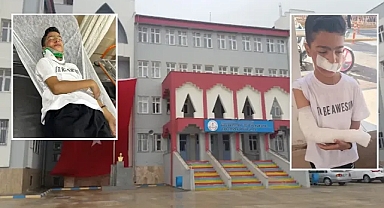 Şanlıurfa’da akran zorbalığı! Çocuğun vücudunda kırıklar oluştu!