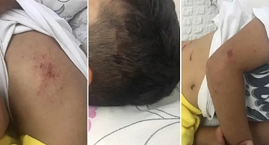 Urfa’da küçük çocuğa köpek saldırdı!