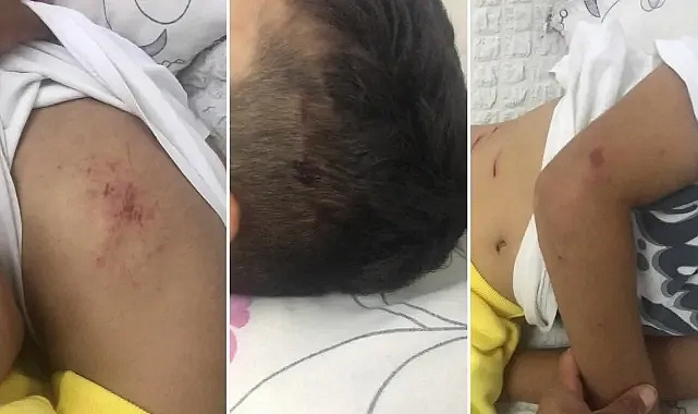Urfa’da küçük çocuğa köpek saldırdı!