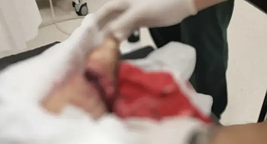 Urfa'da feci kaza! Ayağını kaptırdı