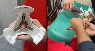 Urfa’da parmağı zeytin kesme makinesine sıkıştı! İtfaiye yardım etti!