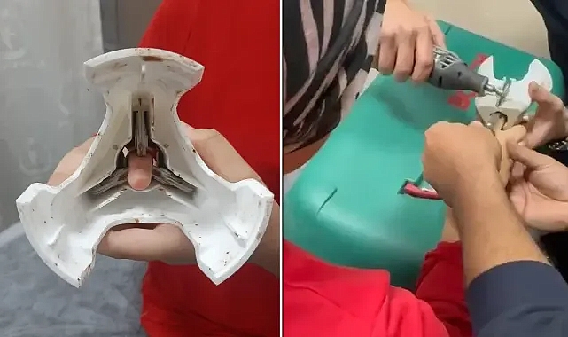 Urfa’da parmağı zeytin kesme makinesine sıkıştı! İtfaiye yardım etti!