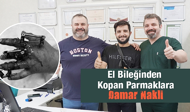 Bilekten, kopan parmaklara damar nakli Metrolife'de yapıldı!