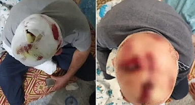 Şanlıurfa’da damat dehşeti! Kayınbabanın kafasına onlarca dikiş atıldı!