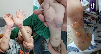 Şanlıurfa’da doktor eksikliği hayatları tehlikeye atıyor!