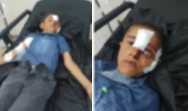 Konya’ya çalışmaya gitti! Urfalı çocuk köpeklerin saldırısına uğradı!