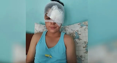 Şanlıurfa’da yine dehşet! Başıboş köpeklerden kaçan çocuğa otomobil çarptı!