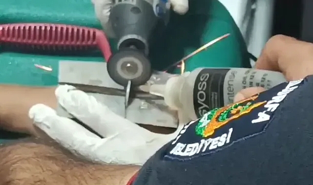 Şanlıurfa’da küçük çocuğun parmağına rondela sıkıştı!
