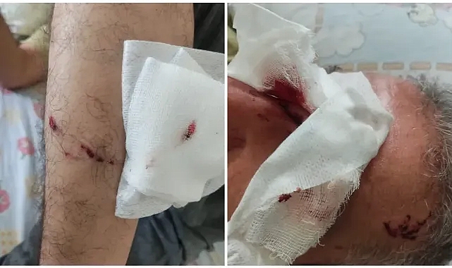 Şanlıurfa’da Sahipsiz Köpek Terörü: Sporcuları Parçalamaya Kalkıştılar