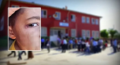 Urfa’da öğrencinin yüzünde sigara söndürülme olayında yeni gelişme!