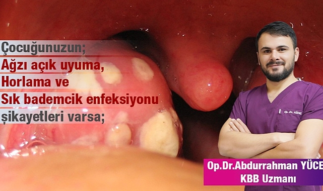 UYARI! Geniz Eti, Çocuğunuzun Büyüme Hızını Düşürüyor Olabilir!