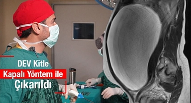Dev Kitle Başarıyla Alındı: 47 Yaşındaki Kadın Sağlığına Kavuştu