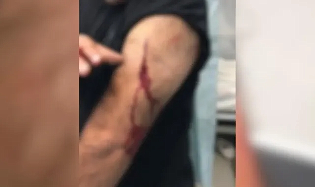 Şanlıurfa'da korkunç olay! Öğretmene jiletli saldırı