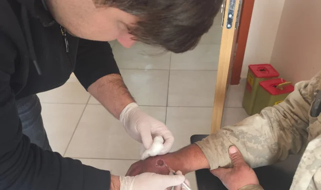 Ceylanpınar'da Şark Çıbanı Vakası Başarıyla Tedavi Edildi