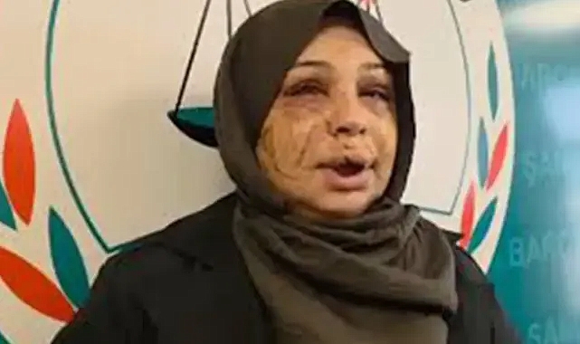 Şiddet gördüğü için Urfa’ya gelmişti! Koca: Tırnak makasıyla yaralandı!