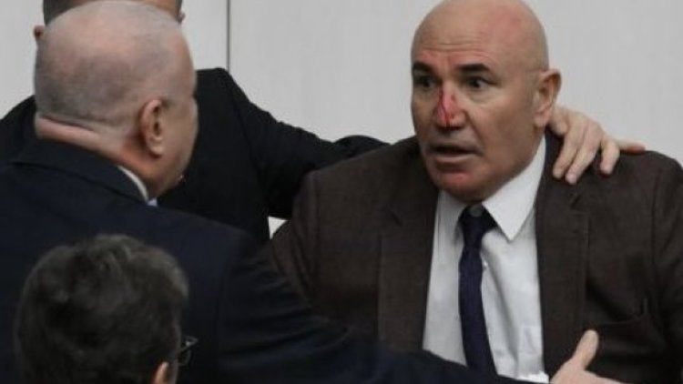 Meclis'te Kavga: CHP'li Mahmut Tanal'ın Burnu Kırıldı