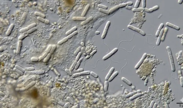 Bağırsak Bakterileri Serotonin Üretimiyle IBS Tedavisinde Umut Olabilir